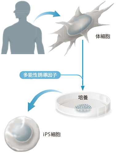 iPS細胞の樹立