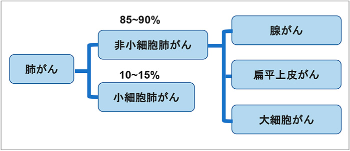 図5　肺がんの種類